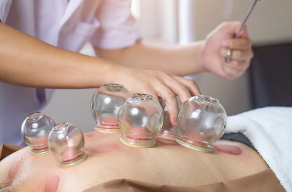 Formation massage cupping à Cambrai avec IHM Nord