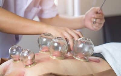 Formation massage cupping à Cambrai avec IHM Nord
